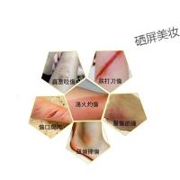 [苏宁优选]澳破痛油 张权香港货原装跌打损伤药油止血刀伤药 外用电焊灼伤