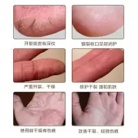 [苏宁优选]脚后跟手足皲裂膏马油膏擦手裂脚裂的油 防裂 防干裂擦脚乳保湿
