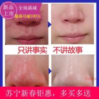 [苏宁易购钜惠]满康宁喜去红鼻子疙瘩酒糟鼻红血丝酒渣鼻鼻螨清本霜满力净软膏