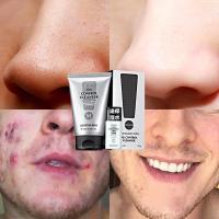 【苏宁优选】男士祛痘印痘疤痘印洗面奶收缩毛孔粗大修复控油去黑头