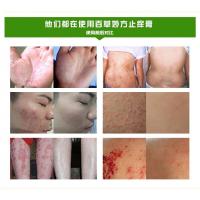 [苏宁优选][专营店]贝婴虎邦迪湿宁御仁肤湿宁霜止痒济寄九杏百立舒乳膏官