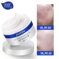 [苏宁优选]怯痘膏去痘印脸上有长痘痘消额头下巴修复霜熬夜却男女豆豆祛痘膏