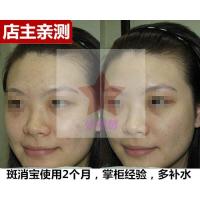 [苏宁优选][优惠]斑消宝云南白药斑消宝霜同款防伪码刮码