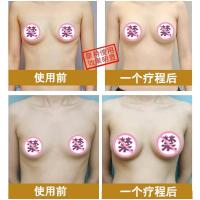 【苏宁优品】★㊣【备注颜色型号】丰胸乳霜产后快速增大纯懒人产品天然精油神器乳贴女非食品