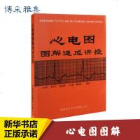 [新华正版]心电图图解速成讲授王建华著 生活医学内科 图书籍天津科技翻译出版