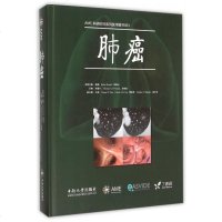 正版新书 肺癌 何建行 [美]托马斯·丹密考 支修益 AME科研时间系列医学图书003 中南大学出版社