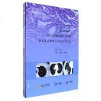 正版新书2015 WHO 2011 IASLC/ATS/ERS肺腺癌病理新分类及临床实践 乔贵宾 中南大学出版社