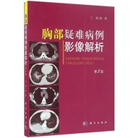[多区域 ]胸部疑难病例影像解析 张嵩 主编 正版外科图书