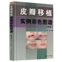 正版 皮瓣移植实例彩色图谱 第2版二版皮瓣解剖部位展示临床书籍 头部颜面部颈部躯干部及四肢部组织缺损与畸形的皮瓣