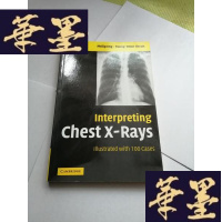 正版旧书INTERPRETING CHEST X-RAYS