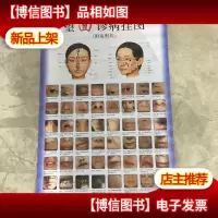 望面诊病挂图 附说明书 实库存 非二手