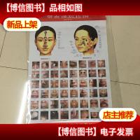 望面诊病挂图 : 附说明书 实库存 非二手