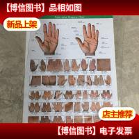 掌纹诊病挂图 实库存 非二手