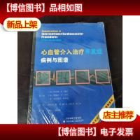 心血管介入*并发症:病例与图谱(国外引进)(中文翻译)