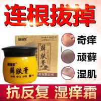 急慢性荨麻疹团断根止痒除皮肤病瘙痒寻麻疹断根不反复膏