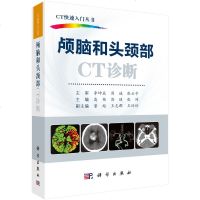 正版 颅脑和头颈部CT诊断 CT快速入书 医学用书 CT检查技术
