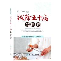 拔除五十病全图解 彩图视频版欧阳颀9787117275811人民卫生出版社