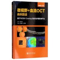 微视野 血流OCT病例图谱 基于N**EK Overlay功能*多模影像平台俞素勤9787313200228