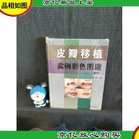 皮瓣移植实例彩色图谱(第2版)