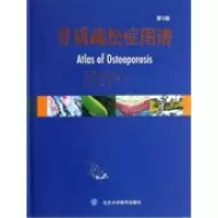 骨质疏松症图谱(D3版)奥尔沃9787565906633
