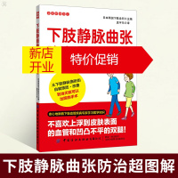 鹏辰正版下肢静脉曲张防治超图解