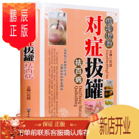 鹏辰正版拔罐书籍 拔罐穴位书 罐到病除对症拔罐祛百病 精装彩图拔罐书 拔火罐书 拔罐穴位图