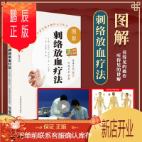 鹏辰正版 图解刺络放血疗法 中医适宜技术操作入门丛书 零基础学中医实用技术 中医刺络放血疗法大全书刺血拔