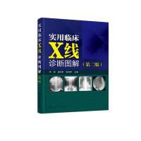 实用临床X线诊断图解 第二版 X线影像鉴别和诊断书 X线读片指南 医学影像学书籍 影像学诊断图谱 影像解剖学图解教材