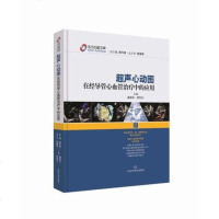 超声心动图在经导管介入治疗中的应用（东方心脏文库） 潘翠珍 舒先红 超声心动影像诊断治疗手册入书籍 上海科学技术出