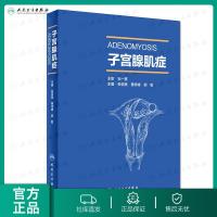 [旗舰店 ]腺肌症 张信美 黄秀峰 郝敏 主编 9787117261524 妇产科学 2018年3月参考书