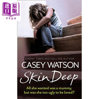 SKIN DEEP 英文原版 肤浅 Casey Watson 父母与大家庭【中商原版】商贸