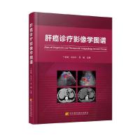 肝癌诊疗影像学图谱 丁世斌 司永仁 吴威 9787538193428 正版 丁世斌,司永仁,吴威 著 辽宁科学技术出版社