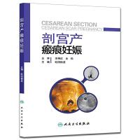 剖宫产瘢痕妊娠 9787117205627 正版 欧阳振波 人民卫生出版社