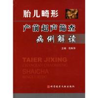 胎儿畸形产前超声筛查病例解读(精) 9787502362775 正版 范斯萍 主编 科技文献出版社