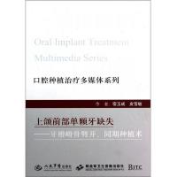 上颌前部单颗牙缺失—牙槽嵴骨劈开、同期种植术 全新 宿玉成 9787509159910 正版 宿玉成