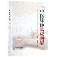  中医脉诊临床图解 中医脉诊 书籍 诊脉书 把脉自学 脉诊入图解 中医脉诊一点通 中医把脉 97871223304