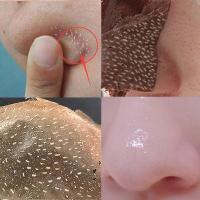 30片去黑头神器男女祛黑头粉刺收缩毛孔撕拉式鼻头吸黑头面膜鼻贴