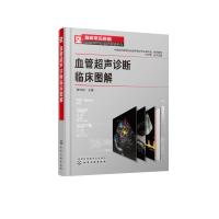 血管超声诊断临床图解 穆玉明 颅脑血管 颈部血管 腹部血管 脉系统 常见疾病诊断与治疗书籍 血管超声检查指南与读片