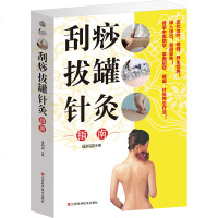 正版 刮痧拔罐针灸指南 传统中医养生精华推拿学 防病/祛病/美容减肥 经络穴位针灸治疗法使用指南 家庭健康医生全书书