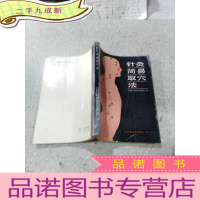 正 九成新针灸简易取穴法