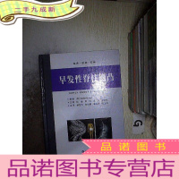 正 九成新早发性脊柱侧凸 .