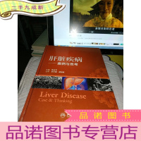 正 九成新肝脏疾病:案例与思考