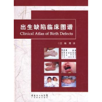 音像出生缺陷临床图谱周沫主编