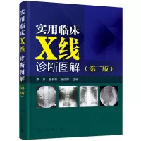 音像实用临床X线诊断图解(第2版)编者:李泉//翟长彬//张成周