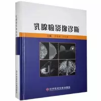 音像乳腺癌影像诊断李智岗,王秋香