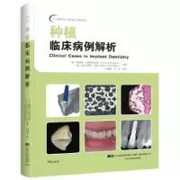 音像种植临床病例解析纳迪姆·卡瑞姆巴克斯