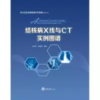 音像结核病X线与CT实例图谱吕圣秀,陈耀凯编著