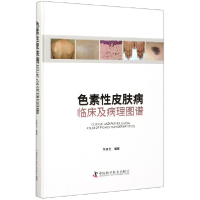 音像色素皮肤病(临床及病理图谱)(精)编者:常建民|责编:孙超