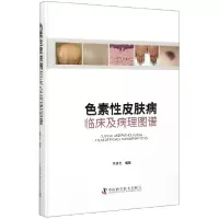 音像色素皮肤病(临床及病理图谱)(精)编者:常建民|责编:孙超