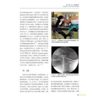 音像上颈椎外科学(瑞士)Enrico Tessitore[等]原著